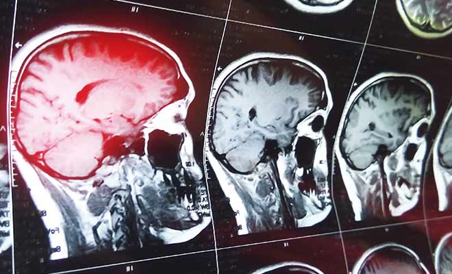 Pediatric Abusive Head Trauma Audio Course