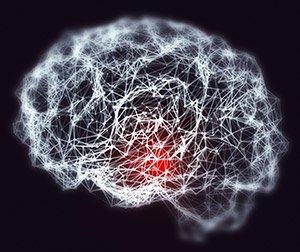Dementia and Alzheimer's disease medical concept
