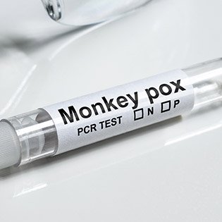 Testing for Monkeypox