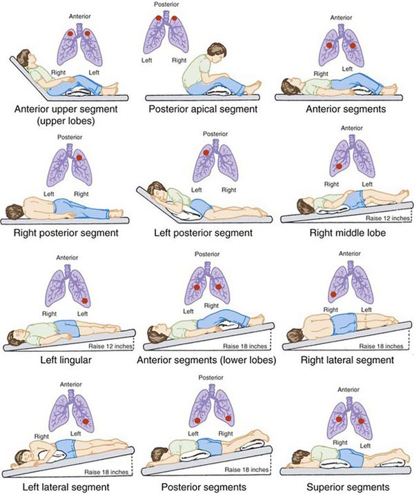 Positions used in airway clearing treatments