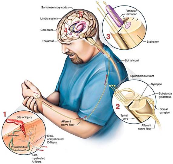 Dignity Health, Psychogenic Pain Is Real Pain: Causes and Treatments