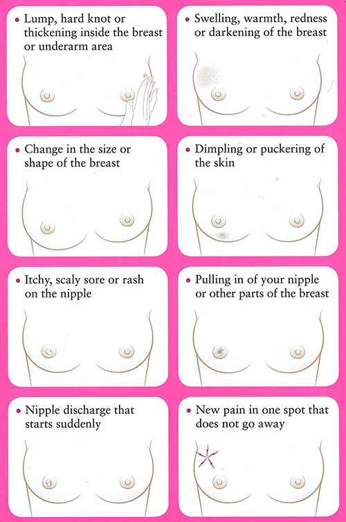 Possible warning signs of breast cancer