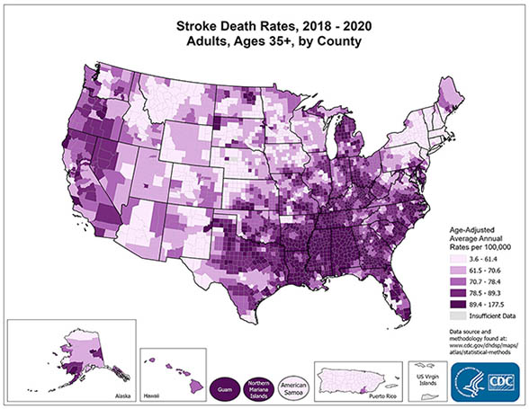 Stroke death rates for adults in the United States, ages 35+, by county, 2018-2020