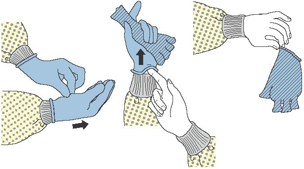 Removing gloves (PPE).