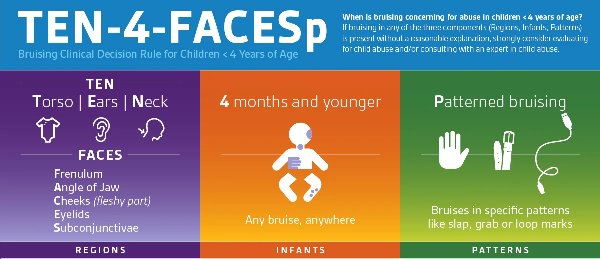 TEN-4-FACESp bruising clinical decision rule for children under 4 years of age