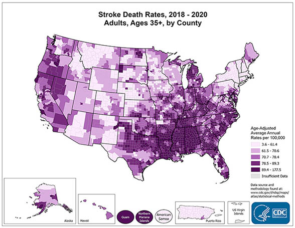 Stroke death rates for adults in the United States, ages 35+, by county, 2018–2020