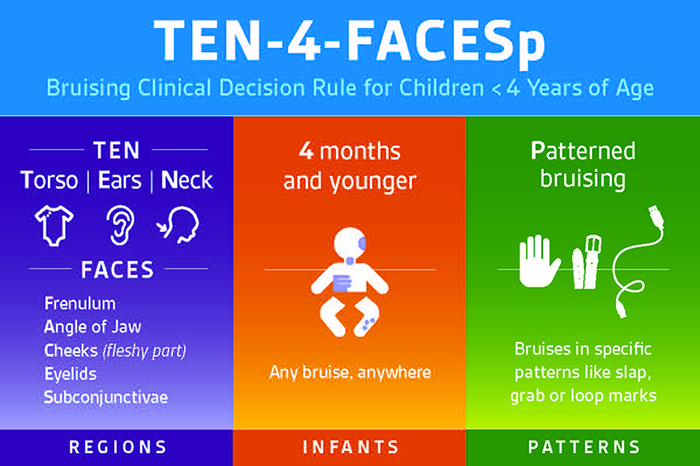 TEN-4-FACESp bruising clinical decision rule for children under 4 years of age